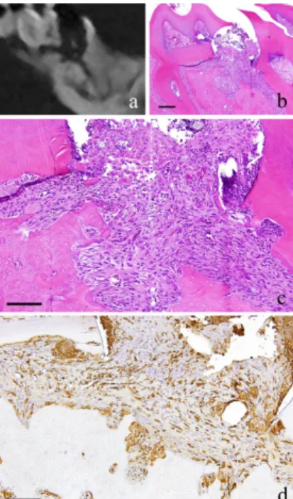 Figure 1. 2-week-specimen. a: m_CT image; b: Histopathological view of the  same part of a, Scale bar=200µm; c: Enlarged view of b, Scale bar=100µm; d: 