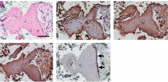 Figure 5.  Histological analysis of the mineralized matrix formation. Histological analysis of the mineralized matrix formation in  unsorted PDL- (A–C, J–L), NSP- (D–F, M–O), and SP-hydroxyapatite (HA) disks (G–I, P–R) at 4 (A–I) and 12 (J–R) weeks after t