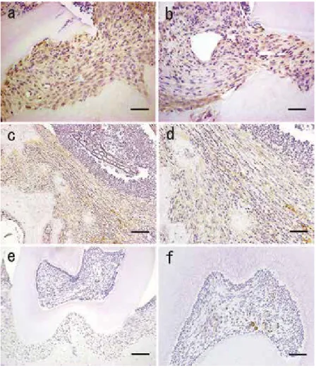 Figure 7. IHC images of notch expression. (a) Granulation tissue area, scale bar = 50  μ m; (b) granulation tissue area, scale bar = 50 μm; (c) ębrous rich area, scale bar = 100 μm; (d) enlarged view of c, scale bar = 50 μm; (e) control areas (dental  pulp
