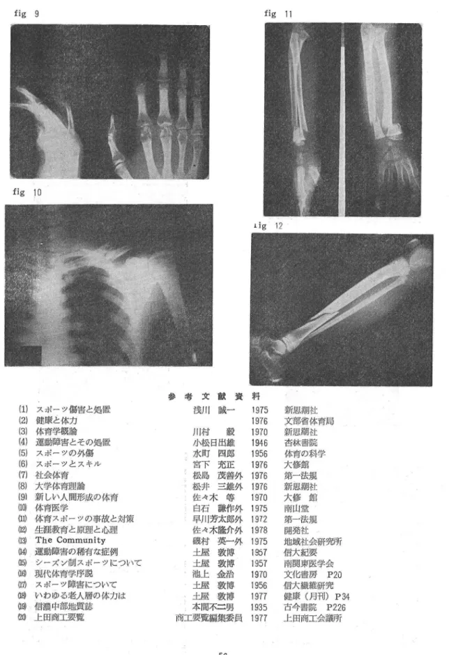 fig 9 fig 10 （1｝ （2） （3） （4） （5） （6） （7） ｛8） ⑨ （10） ω ⑫ ⑬ ⑭ as） ⑯ （IT ⑱ ⑲ ⑳ スポーツ傷害と処置健康と体力体育学概論運動障害とその処置スrk° 一一ツの外傷スポーツとスキル社会体育大学体育理論 新しい人間形成の体育体育医学 体育スポーツの事故と対策生涯教育と原理と心理The Community運動障害の稀有な症例 シーズン制スポー一ツについて現代体育学序説スポーツ障害についていわゆる老人層の体力は信濃中部地質誌 上田商工要覧 参 考 