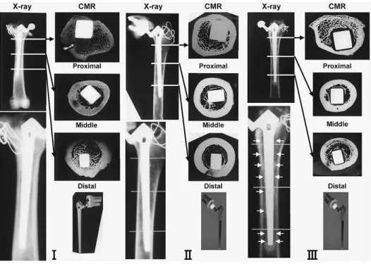 Fig. 3.  Cementless artificial hip joint for canine. (X-ray, CMR) I: Full coating stem (12 Months post operation)