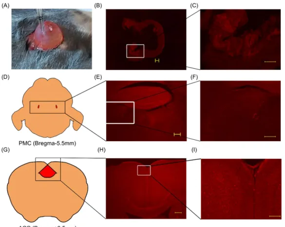 Figure 3. The pathway from ACC to bladder 