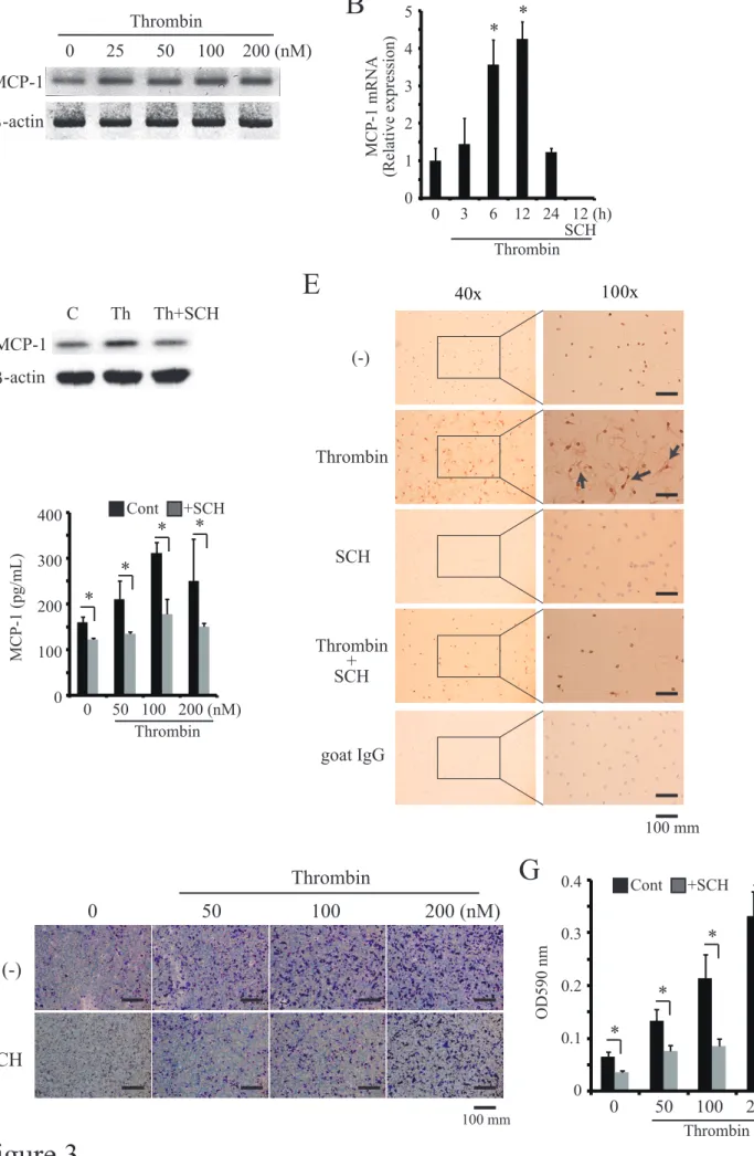 Figure 3AD 543210MCP-1 mRNA(Relative expression)