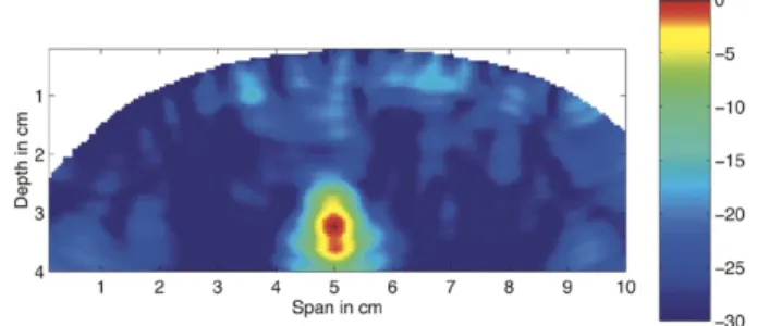 図 2.4: MIST ビームフォーミングでの画像化例 ( 出典 :Microwave imaging via space- space-time beamforming for early   detection of breast cancer)