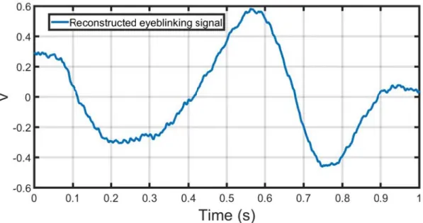 Figure 4   In the norm measure the  wave blinking  task, we  due to th toward le and if th value for     4.22 Reconstn figures  4.2malized ampl d by Doppleeform and  asignal whenselected thhe phase sheft or right. e selected sr this subject tructed blink22