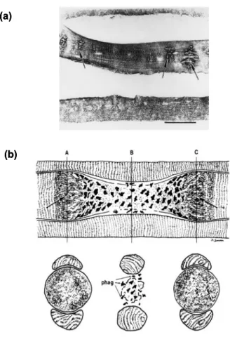 Fig. 3    (a) Titin immunoreactivity in a longitudinal section of EDL muscle, 1 day  after eccentric contractions