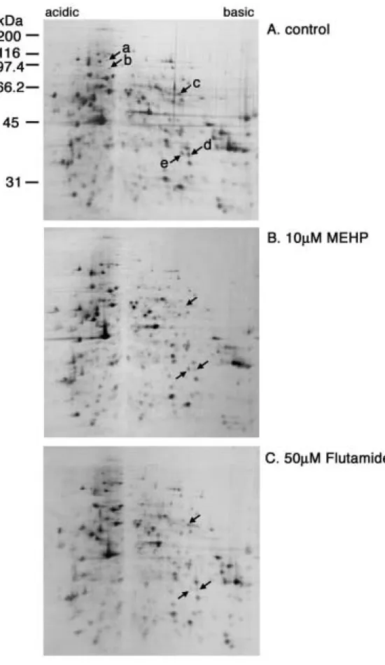 図 23.  セルトリ細胞株 TM4 に MEHP、Flu を投与したときの抽出タンパク質の二次元電気泳動像。コント ロールと比べ変化の見られたスポットを矢印 a 〜 e で示した。 a, b:  コントロールには存在するが、 MEHP 、 Flu 投与では存在しない。 c:  コントロール、 Flu 投与では存在するが、 MEHP 投与では極めて少ない。 d: 