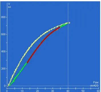 図 3:  上方に凸の形状の吸気カーブ。肺リクルートメントの可能 性が低いことを示す 図 4:  上方に凹の形状の吸気カーブ。肺リクルートメントの可能 性が高いことを示す 基準2：線形コンプライアンス（C LIN ） コンプライアンスとは、吸気プレッシャー/ボリュームカ ーブの傾きを意味します。加えられた圧力の範囲内で傾き が一定の場合、コンプライアンスは線形になります。線形 コンプライアンスを見ることで、圧力増加中にどの程度の 肺胞が開通するかを判断できます。C LIN が高い（> 50～60 mL