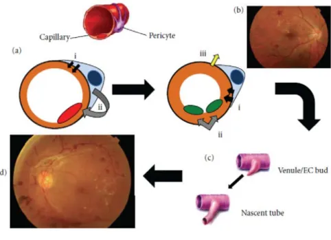 Fig. 1    Schematic representation of the progression of diabetic retinopathy   
