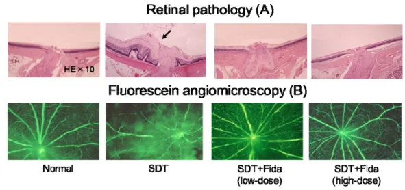 Fig. 10    Effect of fidarestat on diabetic retinopathy