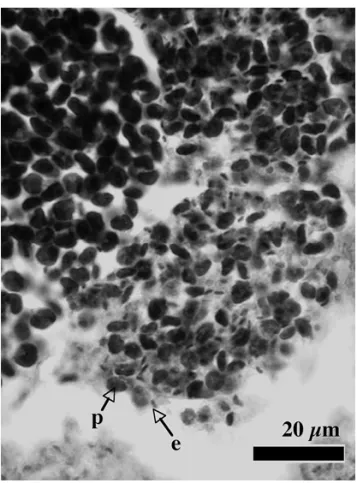 Fig. 3. Diameter frequencies of developing oocytes (fixed in 10% formalin) in five female KAJIKA (small egg type) on each sampling date