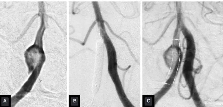 Fig. 1 Case 1