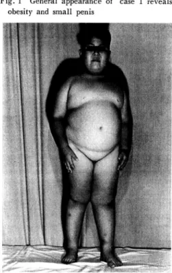 Fig.  1  General  appearance  of  case  1  reveals    obesity  and  small  penis