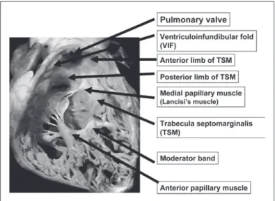 Fig. 1  Ventricular septum viewed from right ventricular side.