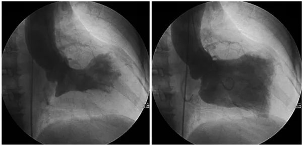 Fig. 3 Coronary arteriograms