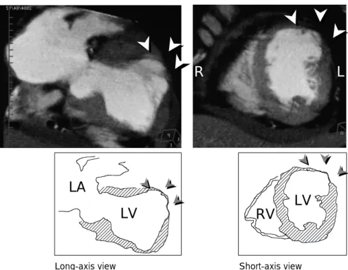 Fig. 5 Surgical operation