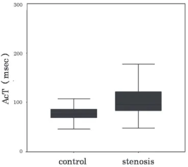Figure 3  Relationship between degree of stenosis by the duplex NASCET method and AcT (r =0.64,  P <0.01).