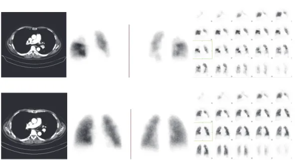 Fig. 1   A 51-year-old man with depression. He suddenly complained of dyspnea in the early  morning