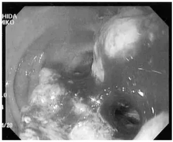 Fig. 1 Gastrointestinal endoscopy