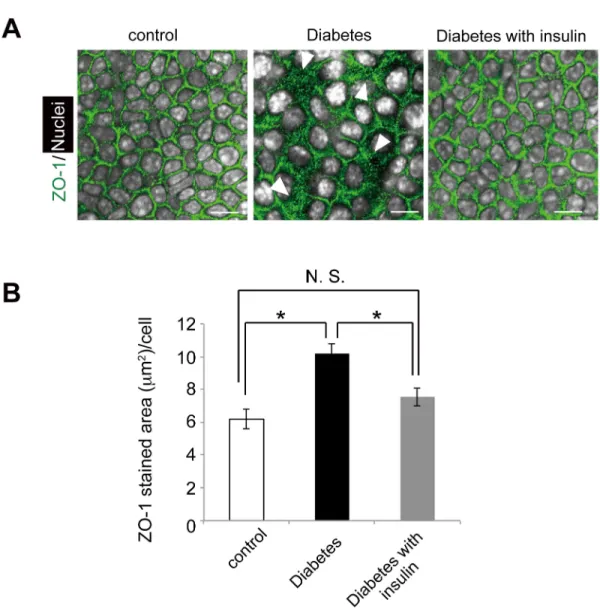 Fig 3. Different distribution of tight junction protein expression in the diabetic mice and the effect of insulin treatment
