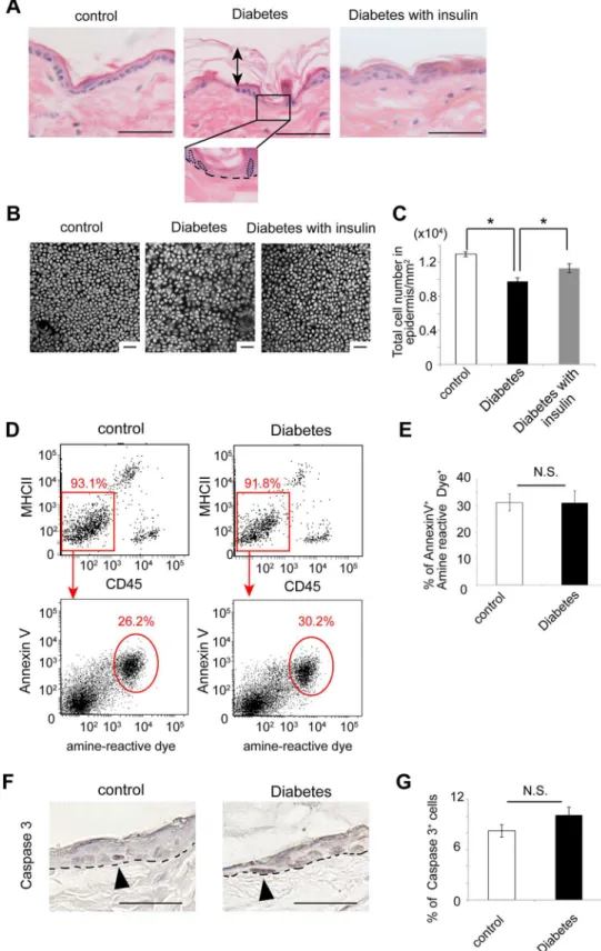 Fig 4. Altered skin morphology but no significant induction of apoptotic cells in the epidermis of the diabetic mice