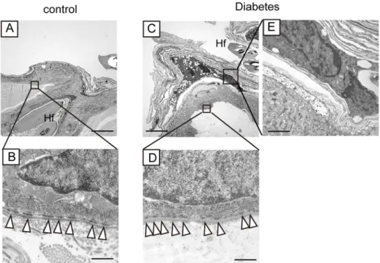 Fig 7. Ultrastructural analyses of non-wounded skin from the diabetic mice. Low magnification of the skin of control and diabetic mice is shown in (A) and (C)