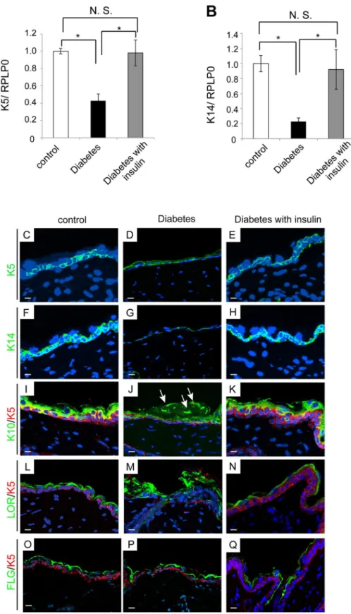 Fig 8. Aberrant expression of skin proliferation/differentiation markers in the diabetic mice