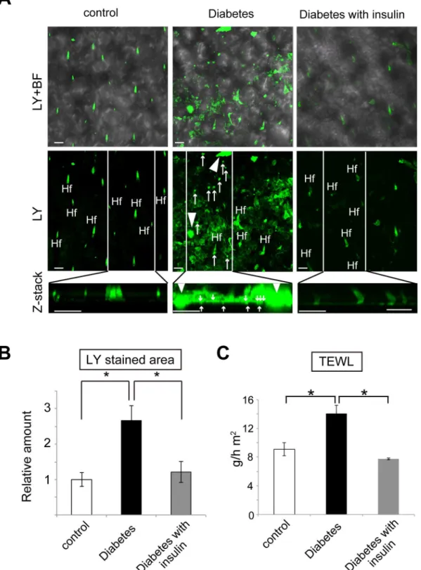 Fig 2. Skin barrier dysfunction in diabetic mice and its mitigation by insulin treatment