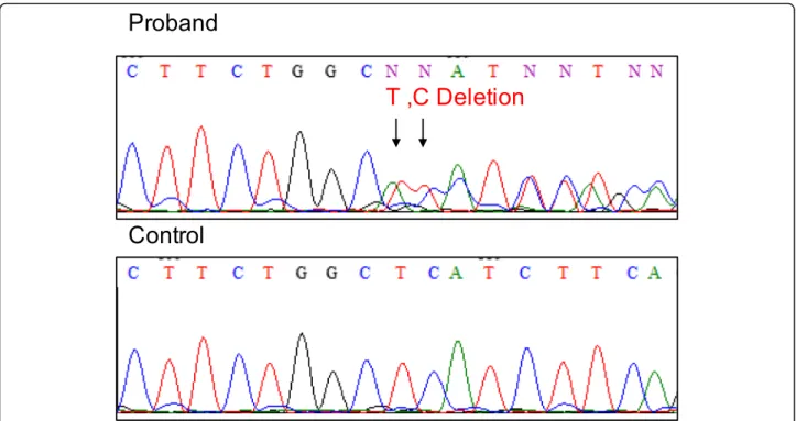 Fig. 4 The genetic analysis results. Genomic DNA sequence of SCN5A from the patient (top) and a control sample (bottom)