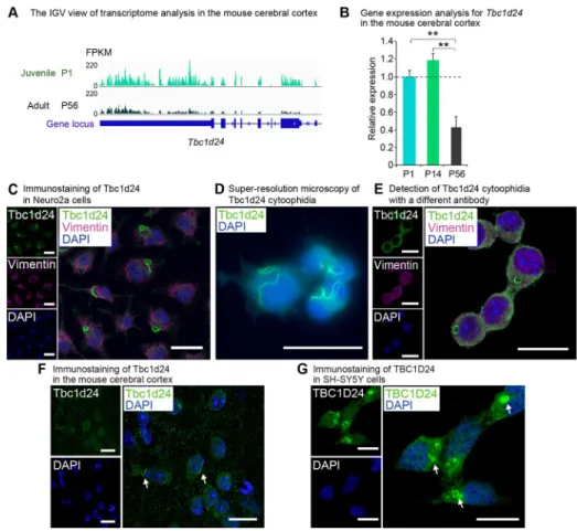 Fig 1. Tbc1d24 is expressed predominantly in juvenile in the cerebral cortex and forms cytoophidia