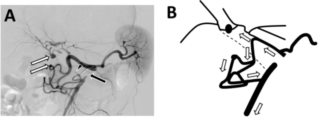 Fig. 2 Angiogram via the celiac artery 