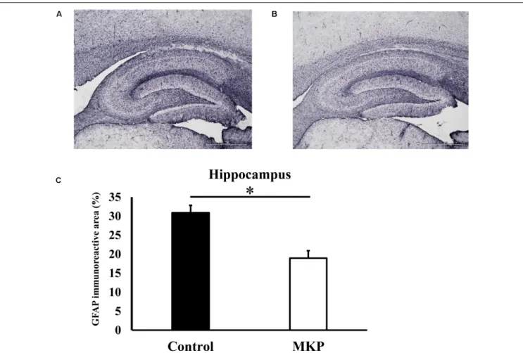 FIGURE 3 | Expression of GFAP in the hippocampus. Immunohistochemistry images of control (A) and MKP (B) are shown