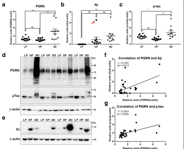 Fig. 6 Biochemical analyses of Progranulin in MTG samples compared to A β and phosphorylated tau