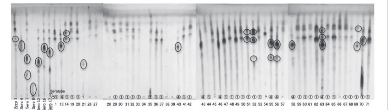 Fig. 3  TLC patterns of GPLs in M. avium strains isolated from patients