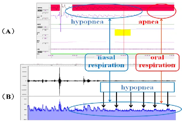 Fig. 5 ． 2 Difference in current of air at the time of mouth respiration and nose  respiration 