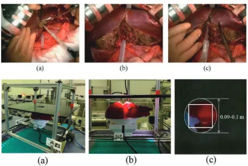 Figure 9. Upper: (a), (b), (c) Strobe shot of actual liver surgery video. Bottom: Occlusion situation