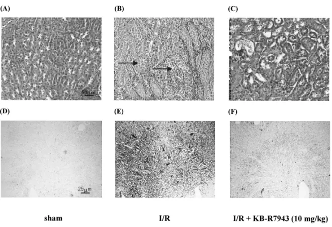 Figure 3. Light microscopy of outer zone outer stripe of the medulla of the kidney of ARF mice treated  with vehicle (B, untreated) and KB-R7943 (C, 10 mg/kg) at 48 h after I/R, and sham mice  (A)