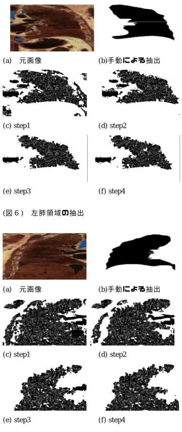 図 ７ ） 右 肺 領 域 の 抽 出  