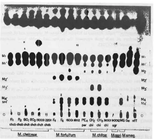 Figure  1 shows  the  thin-layer  chromatographic  profiles  of  total  fatty  acid  methyl  esters 