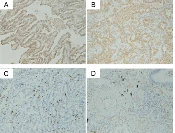 Fig. 1.  Immunohistochemical staining for (A) vascular endothelial growth factor (VEGF), (B) delta-like ligand 4 (DLL4), (C)  Ki-67, and (D) CD31 (x200).