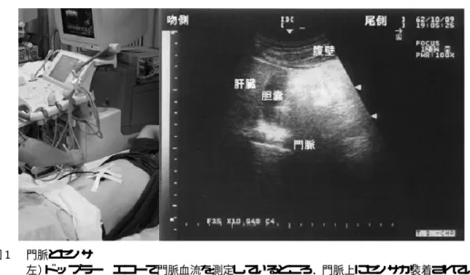 図  門脈とセンサ 左）ド ップラー   エコーで門脈血流を測定しているところ．門脈上にセンサが装着されている． 右）門脈の位置を同定し 、直上の腹壁にセンサを装着する（左図参照） の計 " 名である．表  に被験者のプロフィールを示 す．実験に先立ち，以下に述べるインフォームド ・ コンセントを得た ．すなわち，被験者全員に本実験 の趣旨と方法を詳しく説明し ，さらに，実験への協力 は個人の自由意志で判断すべきこと ，また，協力を 表明した後，いつでも取り消しができることや ，個 人に属する情報の