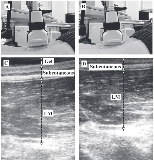 Fig. 3　Measurement of ultrasound imaging of the lumbar multifidus muscle 　　　  (A) The 0.1 N condition