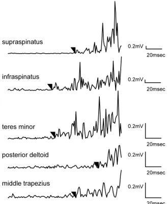 Fig 3. Typical EMG data for muscle activity during shoulder external rotation in 90 degrees abduction position  (90Abd) from single subject