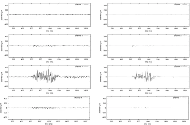 図 2: ノイズ低減前後の連続母音 [イイ] 発声時の表面筋電波形 (右図がノイズ低減処理後) 号が低く安定した状態から始め，計測対象の発声を行っ た後に軽く口唇を閉じた状態に戻すという過程を記録 する．筋電波形データは発声過程ごとに 2 秒間とし，解 像度 12bit，周期 50µs (20,000Hz) でサンプリングした． その際，明瞭な発声となるように注意しつつも自然な 発声と呼べる範囲を逸脱しないように心掛け，無理に 大きく口を動かして口唇形状を強調することは避けた． 筋電信号は微弱であり，獲得し