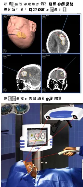 図 1：脳神経外科手術ナビゲーション システムのモニター画像（部分）  図２：患者位置情報の読み込み  脳神経外科手術ナビゲーションシステム 名鉄病院脳神経外科  名鉄病院脳神経外科では、平成 17 年３月に BrainLab 社製の脳神経外科手術ナビゲーションシステムの導入が決まり、8 月から実際に臨床応用を開始しました。これまでの約１年間に、多数の手術に用いることが出来、大変良い手術支援システムであることが実感されています。本稿では、この最先端の手術支援システムについて、その機能を実際の手術症例に沿って