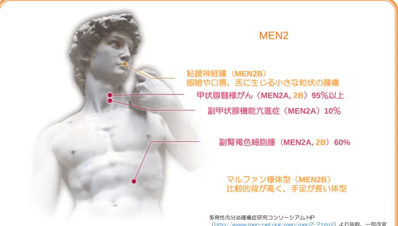 図 1  多発性内分泌腫瘍症 2 型（MEN2）のタイプ別にみられる主な病変と発症頻度 