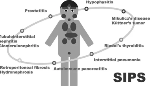 図 6 全身性 IgG4 関連疾患（systemic IgG4-related plasmacytic syndrome ; SIPS）の概念