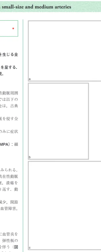 図 11.7　結節性多発動脈炎（polyarteritis nodosa） a：強い浸潤を触れる結節．b：融合した紫斑．c：進 行し，潰瘍をきたした例．abcd e f habcdefggh ii jj kk ll mm nn oo ppabcdefhabcdefgghiijjkkllmmnnooppabcdefhabcdefgghiijjkkllmmnnoopp