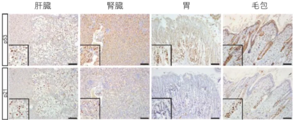 図 2：作製したキメラマウスにおいて、腫瘍の形成が認められなかった多くの組織では細胞老化が起こ っていた     ここに示す全ての組織（肝臓、腎臓、胃、毛包）では細胞老化に関与する p53 や p21 遺伝子の 発現が確認され、細胞老化が起こっていることがわかった。  図 3：細胞老化の誘導による新たながん治療法開発の可能性  同じ遺伝子変異をもつにもかかわらず、細胞老化を回避できる細胞は末梢神経の細胞のみであった。 細胞老化の誘導／回避にはエンハンサー領域の違いが重要であることを明らかにした。CCS 細胞