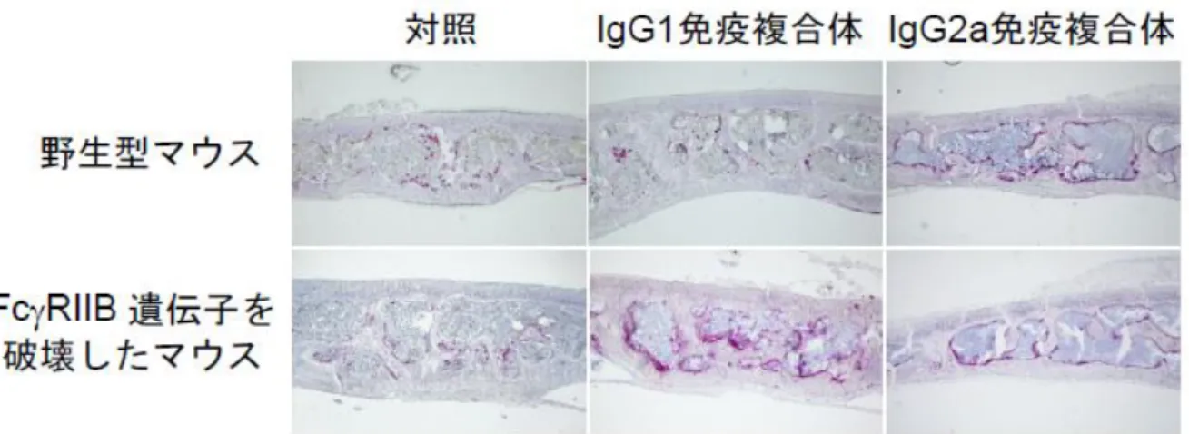 図 2  IgG 免疫複合体による破骨細胞を介した骨の破壊  IgG1 免疫複合体を野生型または FcγRIIB 遺伝子を破壊したマウスの頭蓋冠下に投与すると、 FcγRIIB 遺伝子を破壊したマウスでのみ破骨細胞が増加（下段中央、赤色）し、骨破壊の誘導 が見られました。また IgG2a 免疫複合体は FcγRIIB 遺伝子を破壊したマウスだけでなく、野生 型マウスにおいても破骨細胞による骨破壊の誘導が見られました（右）。この際、骨破壊部位 に炎症性細胞の浸潤は見られず、免疫細胞が関与することなく、免疫複合